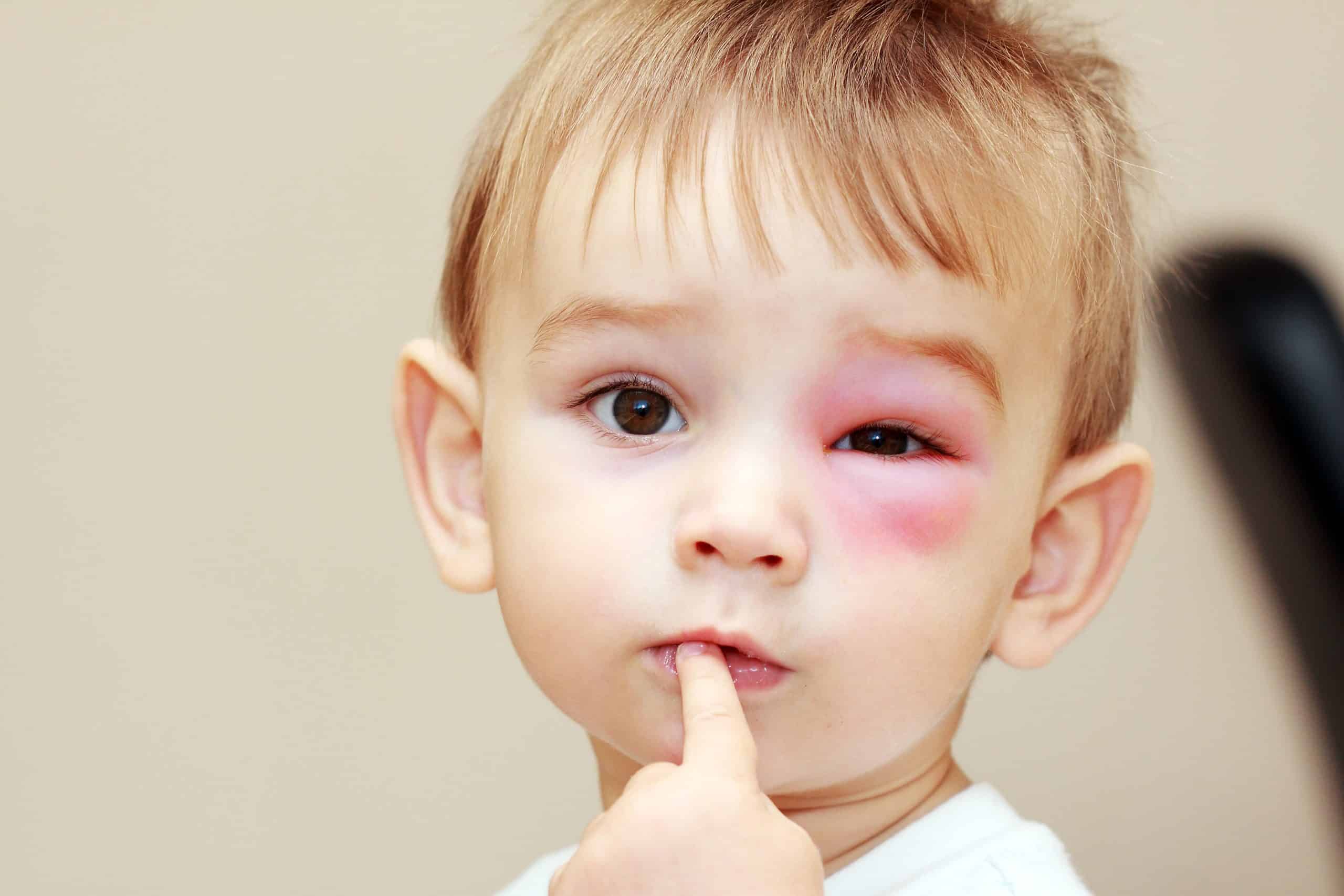 Tips on How to Prevent Eye Injuries in Children | Laurier Optical